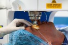 лазерная операция на глаза