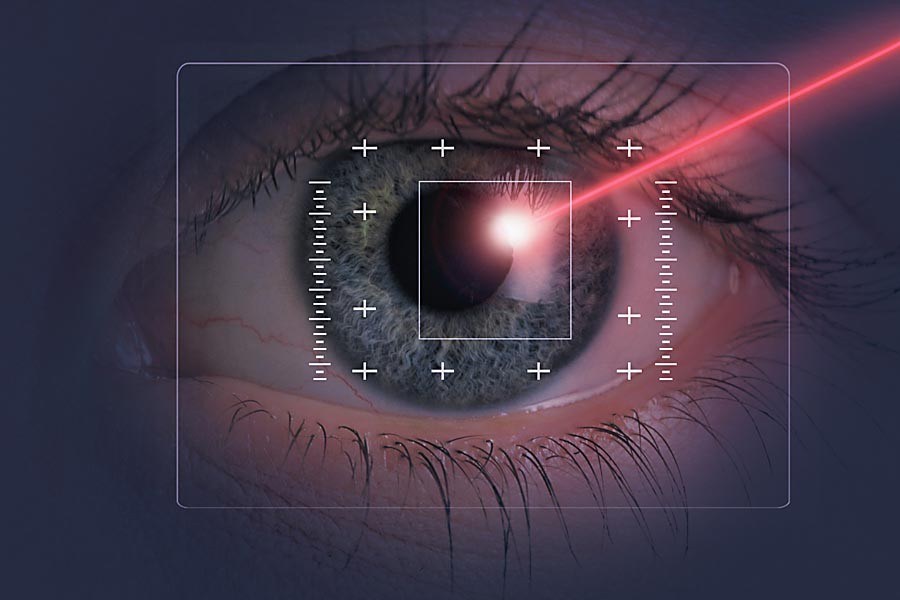 Лазерная коррекция зрения | Центр восстановления зрения, Сахалин